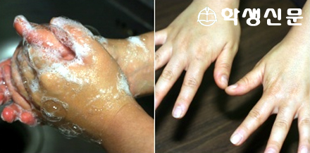 ºñ´© ¼Õ¾Ä±â¸¸ ÀßÇØµµ ¼¼±Õ Á¦°Å ÃæºÐ!